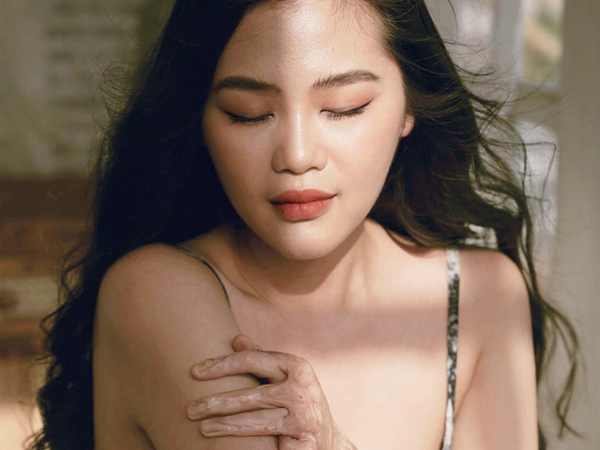 Gặp cô giáo xinh đẹp bị bỏng nặng do nổ bóng bay: 'Mình vẫn đang sống và càng phải sống mạnh mẽ hơn bất cứ lúc nào'