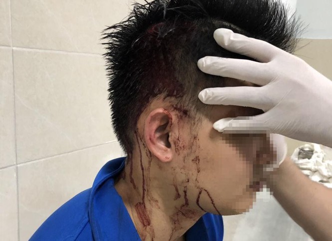 Nam thanh niên bị đánh hội đồng, bắn đạn bi vào đầu trước cửa trung tâm thương mại