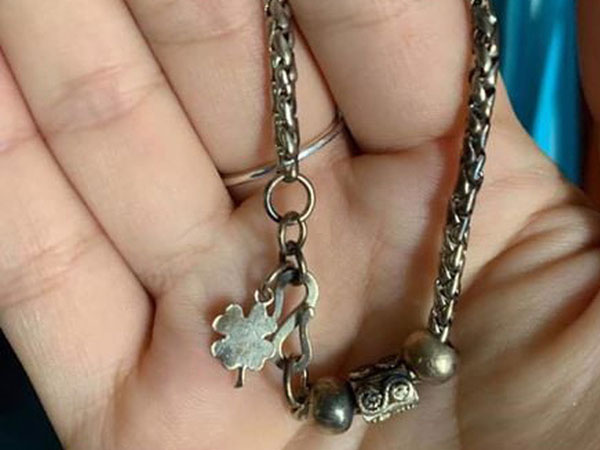 Gia đình hốt hoảng phát hiện bé gái 3 tuổi nuốt chiếc vòng trang sức của mẹ vào bụng