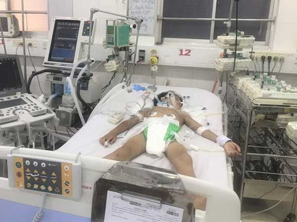 Bệnh nhi 4 tuổi tử vong do bệnh bạch hầu dù đã tiêm vắc xin: Chuyên gia lý giải nguyên nhân