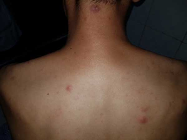 Khám qua 4 bệnh viện, người đàn ông phát hiện mắc căn bệnh bị hắt hủi