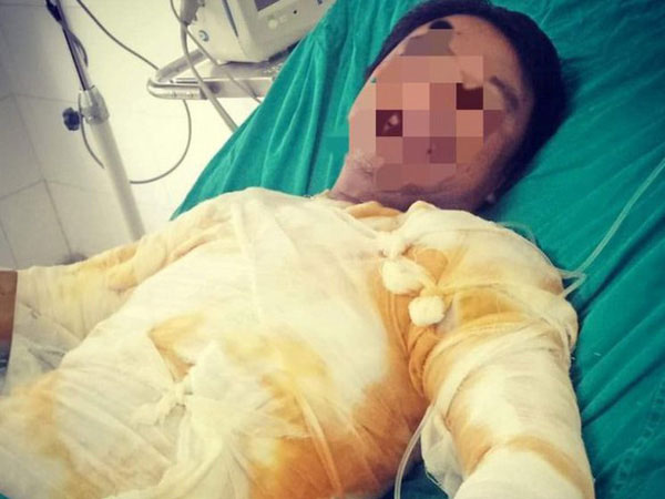 Đình chỉ 8 người liên quan vụ công nhân bị điện giật bỏng nặng