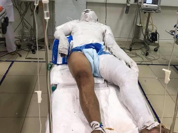 Vụ nam thanh niên ở Nghệ An bị chặn đường đổ xăng đốt: Vì món nợ 2,5 triệu đồng?