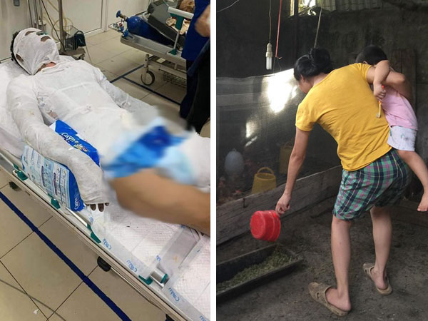 Vụ thanh niên bị đồng nghiệp cũ tạt xăng thiêu sống: Vợ trẻ nén đau thương, vay mượn khắp nơi giành giật sự sống cho chồng