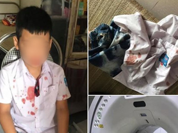 Vụ người đàn ông đấm hộc máu mồm bé trai lớp 1 để 'trả thù' thay con: Mẹ nạn nhân lên tiếng
