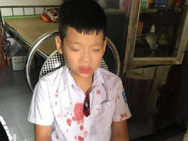 Bé trai lớp 1 bị người đàn ông hành hung để 'trả thù' đang hoảng loạn, không muốn đến trường học