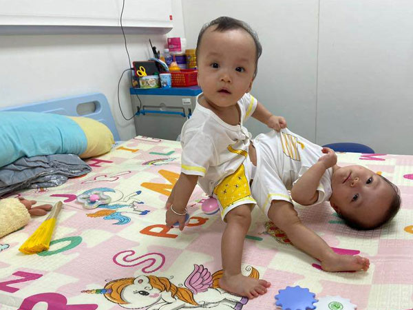 Lời cầu nguyện của Giám đốc BV Nhi trước đại phẫu 100 bác sĩ cho cặp song sinh dính liền