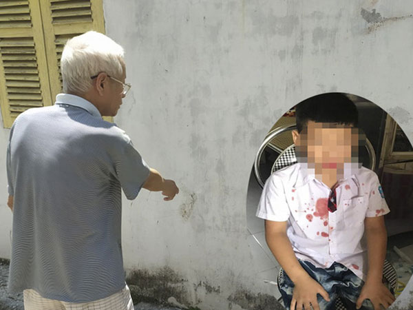 Khởi tố người đàn ông hành hung bé trai học lớp 1 ở Hoà Bình