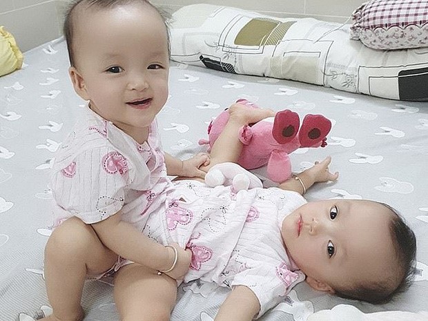 Ca phẫu thuật tách rời thành công cặp song sinh Trúc Nhi - Diệu Nhi của các y bác sĩ Việt Nam thu hút sự chú ý báo chí nước ngoài
