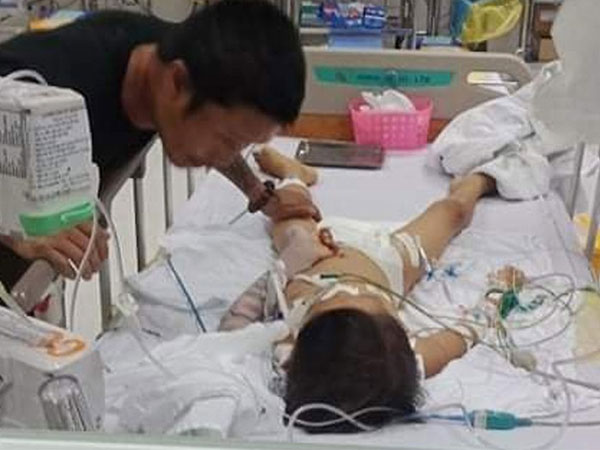 Bé 7 tuổi ở Bình Phước đã tử vong sau ca mổ lấy đinh nẹp xương tay