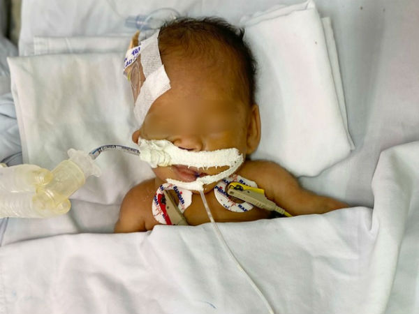 Thương tâm: Bé trai sơ sinh nặng chỉ 1,4kg bị bỏ rơi trước cổng chùa, mắt lồi, người đầy vết tiêm chích
