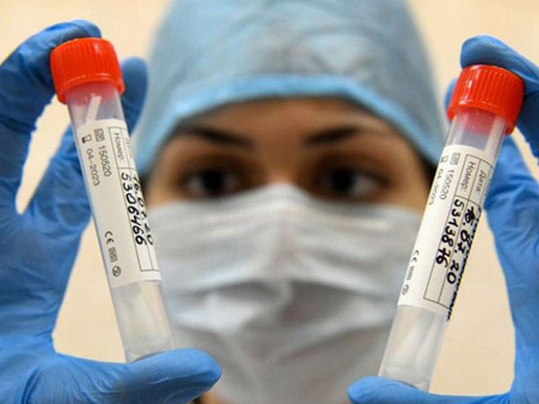 Nga sẽ sản xuất vaccine ngừa Covid-19 vào tháng 11