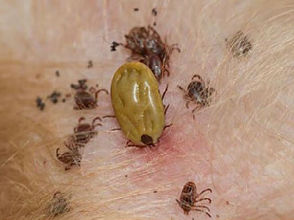 Virus Bunya bùng phát ở Trung Quốc: Đã xuất hiện từ 10 năm trước, gây chết người, lây bệnh qua máu và vết thương hở