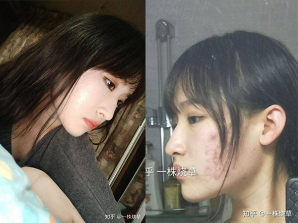 Gái xinh công khai chuyện photoshop da để sống ảo, nói hộ nỗi lòng của team bị mụn hành hạ