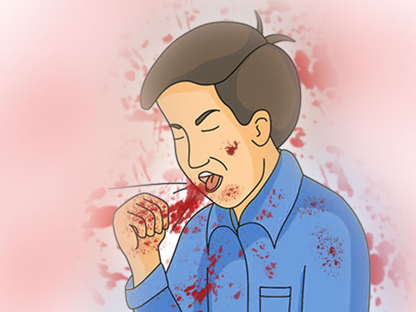 Người đàn ông 'ho ra máu sét đánh'