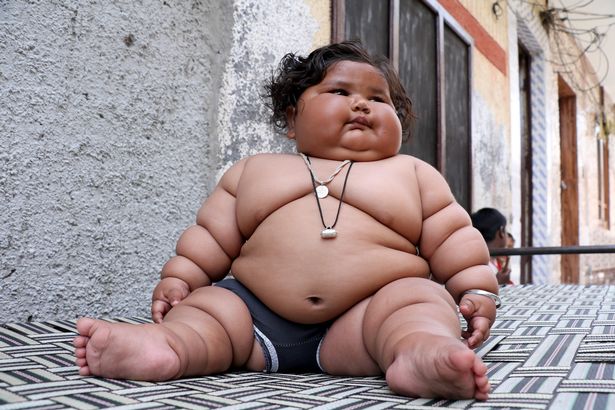 Bé gái ú na ú nần đột nhiên nổi tiếng vì 8 tháng tuổi đã nặng 17kg, sau 2 năm giờ ra sao?
