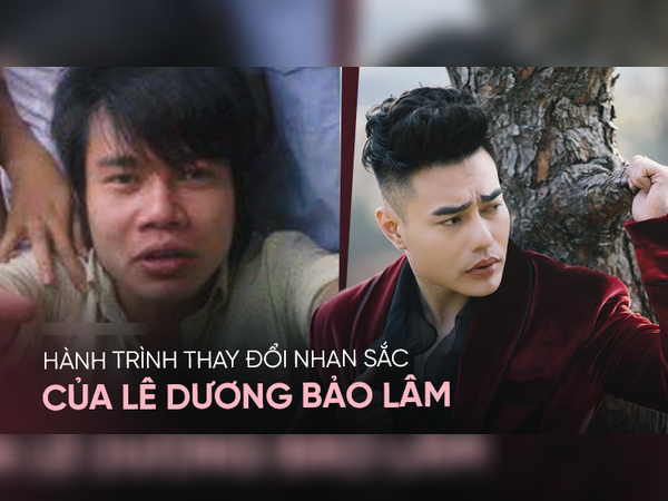 Hành trình 'dao kéo' đau đớn của Lê Dương Bảo Lâm: Chấp nhận phẫu thuật 10 ngày/lần, 3 phen cưa răng theo trend