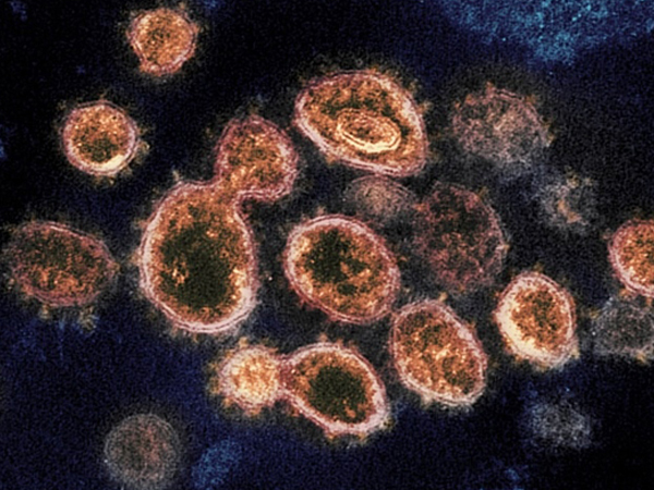 Đã có kết quả nguồn gốc virus gây Covid-19 ở Hải Dương