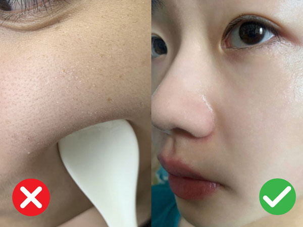 Dùng serum chứa Hyaluronic Acid để cấp ẩm thì quá chuẩn, nhưng bôi sai cách thì da sẽ khô như bị vắt kiệt nước