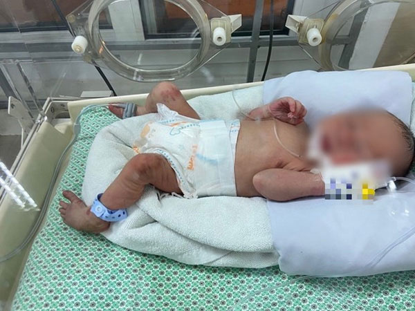 Bé sơ sinh bị bỏ rơi giữa khe tường nhà được ông ngoại đến làm thủ tục nhận cháu