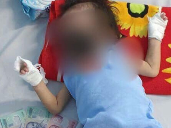 Kẻ gian nhẫn tâm lấy hình ảnh bé gái 15 tháng tuổi bỏng nặng đăng Facebook, bịa chuyện điều trị ở BV Chợ Rẫy để trục lợi