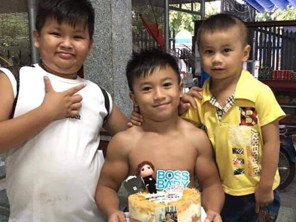 Cuộc sống của cậu bé 10 tuổi mắc hội chứng 'superman' hiếm gặp tại Việt Nam