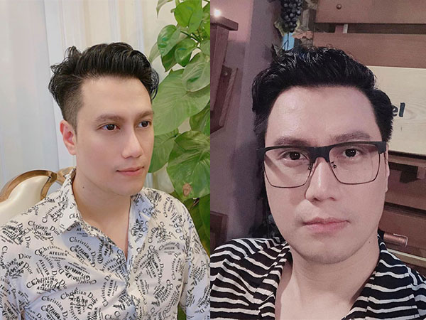 Việt Anh nhận được nhiều lời khen ngợi khi công khai ảnh chụp cận gương mặt sau 1 năm phẫu thuật thẩm mỹ