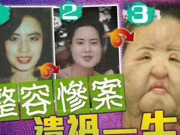 Xót xa 'thảm hoạ dao kéo' Han Mi Ok: Mỹ nhân biến dạng vì nghiện thẩm mỹ, mua dầu ăn về tự tiêm và cái chết bí ẩn tuổi 57