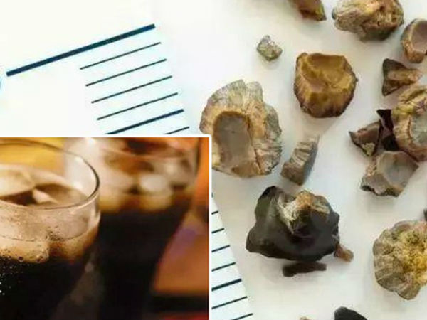 Loại nước uống này rất được ưa chuộng trong mùa hè nhưng lại là 'khắc tinh' của thận, uống nhiều dễ dẫn đến sỏi thận, nhiễm độc