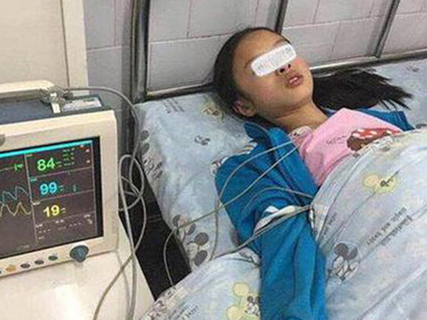 Nặn mụn trên mặt, cô gái 19 tuổi bị nhiễm trùng nội sọ, nếu không được cứu chữa kịp thời có thể nguy hiểm tính mạng