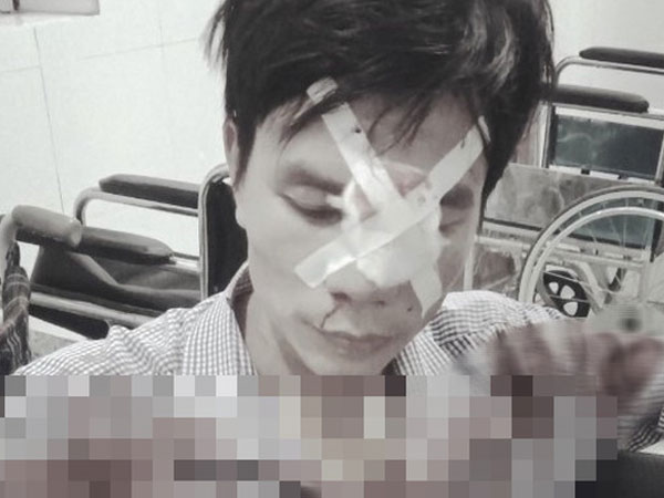Nam thanh niên tố bị cán bộ địa chính xã dùng xẻng đánh vào mặt sau va chạm giao thông