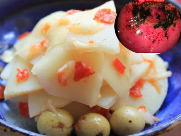 Người đàn ông 35 tuổi loét dạ dày vì thích ăn măng ớt