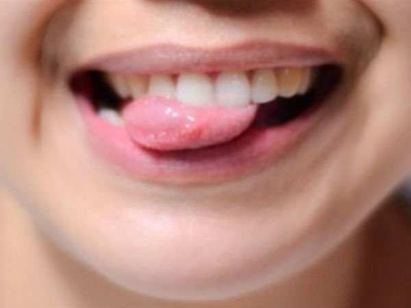 Lưỡi không chỉ giúp bạn nói mà ngay cả các loại bệnh nguy hiểm nó cũng 'lên tiếng' được thông qua 5 dấu hiệu