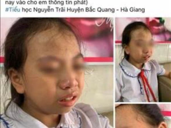 Hà Giang: Tạm đình chỉ cô giáo tát học sinh lớp 4