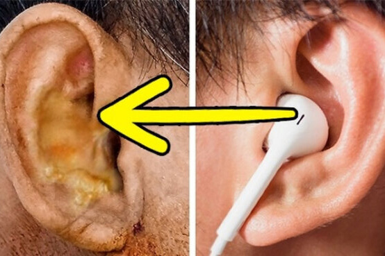 Hiểm họa khôn lường từ việc dùng chung tai nghe