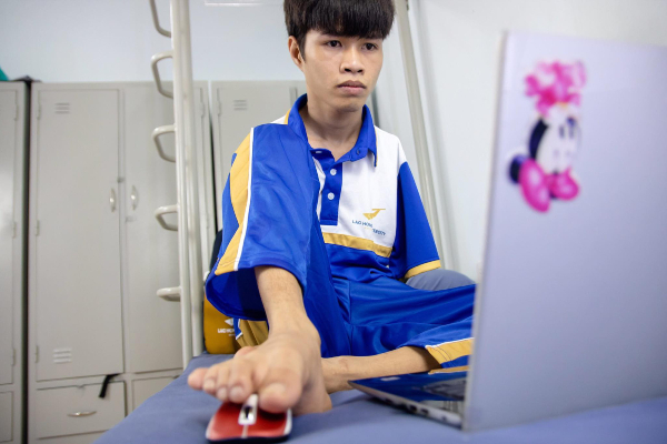 Cậu bé 'chim cánh cụt' không tay ngày nào đã trở thành sinh viên, còn được làm việc trong Google
