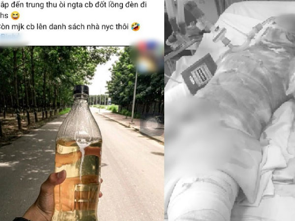 Thương tâm: Thiếu nữ bị bỏng đến 95%, nghi do bạn trai tưới xăng đốt tại vườn cao su ở Bình Dương