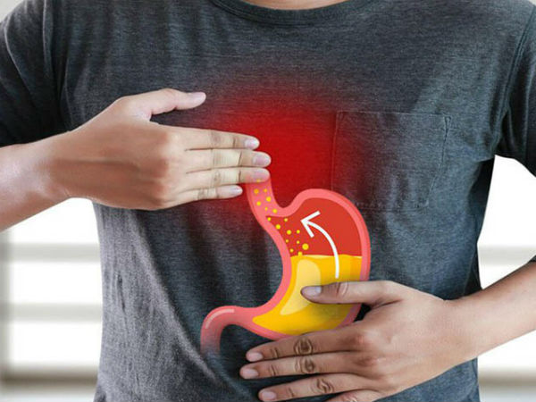 Trào ngược dạ dày: Bệnh của 'thời đại mới', tác nhân lớn nhất gây ung thư dạ dày và 7 điều buộc phải làm để không rơi vào cảnh bệnh tình