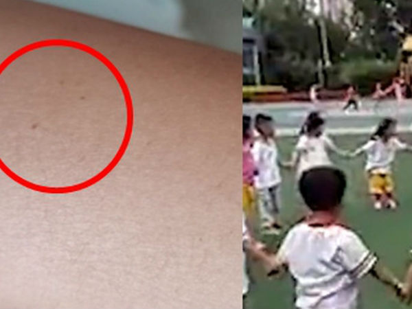 Hàng loạt học sinh mẫu giáo có vết kim đâm kỳ lạ trên cơ thể, lời kể của những đứa bé khiến ai cũng phải xót xa