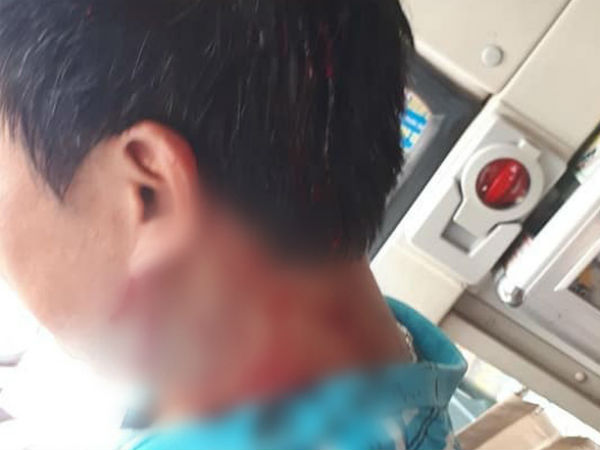 Hà Nội: Nhân viên phụ xe khách bị đánh gục khi vừa rời cổng bến xe Giáp Bát