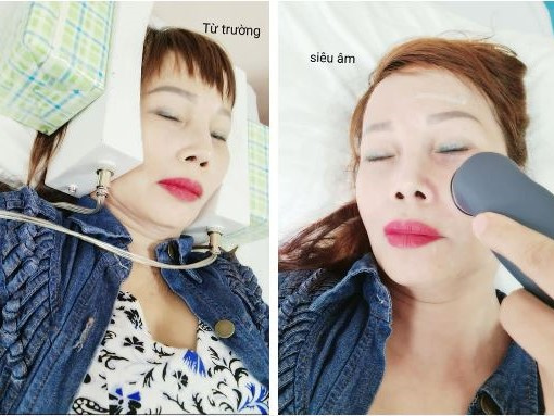Cô dâu 62 tuổi xuống Hà Nội điều trị méo miệng sau cuộc đại phẫu căng da mặt: 'May chị đi khám, bác sĩ nói để lâu là méo miệng cả đời'