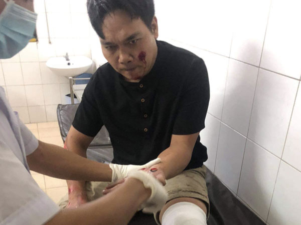 Thương tâm: Truy bắt kẻ trộm từ Đồng Nai sang Bình Dương, 2 hiệp sĩ trọng thương, 1 người chết não