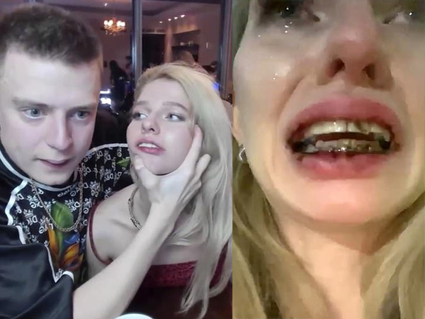 Mẫu nữ bị đánh đập dã man đến gãy cả niềng răng khi đang livestream trên kênh YouTube có gần 700 nghìn subscriber