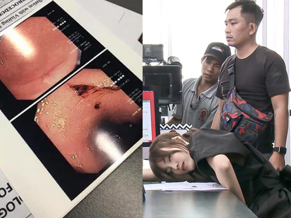 Netizen xót xa 'đào' lại ảnh Lan Ngọc kiệt sức ở phim trường, nội soi dạ dày viêm loét đến chảy máu trước khi phát hiện ung thư