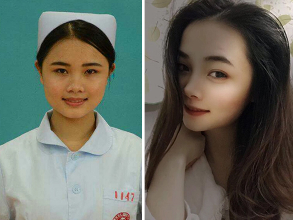 Y tá chặt xác bác sĩ vì bị tống tình