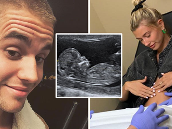 Bà xã Justin Bieber mang thai con đầu lòng?
