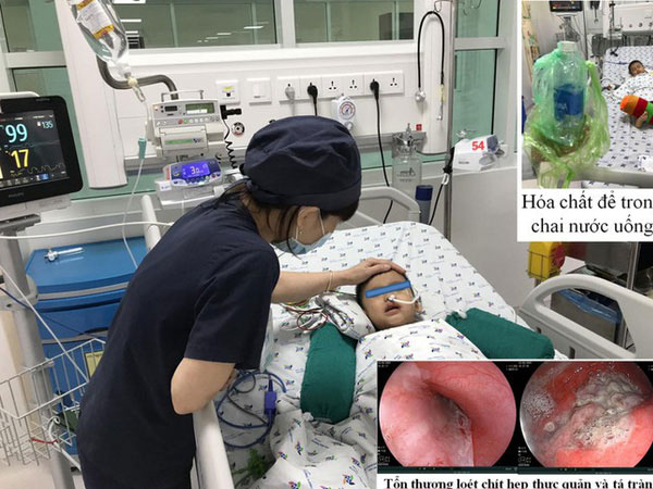 Bé 3 tuổi nguy kịch vì uống nhầm hóa chất