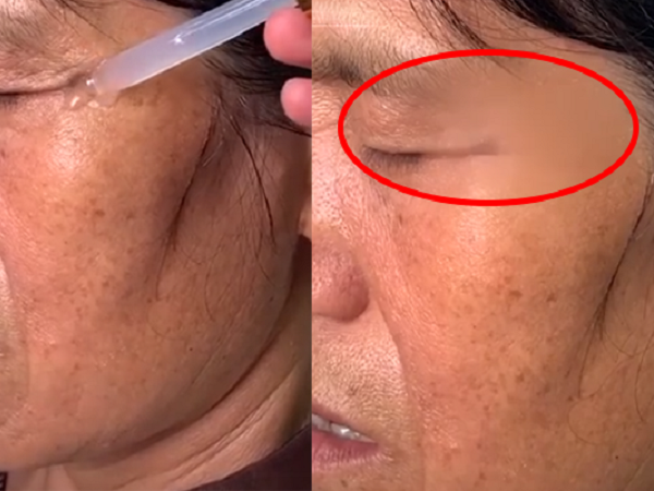 'Thần dược' xóa nhăn được quảng cáo rầm rộ trên Tiktok giúp da căng mịn trong vài giây, nhưng 1 chi tiết giả trân khiến dân mạng phì cười