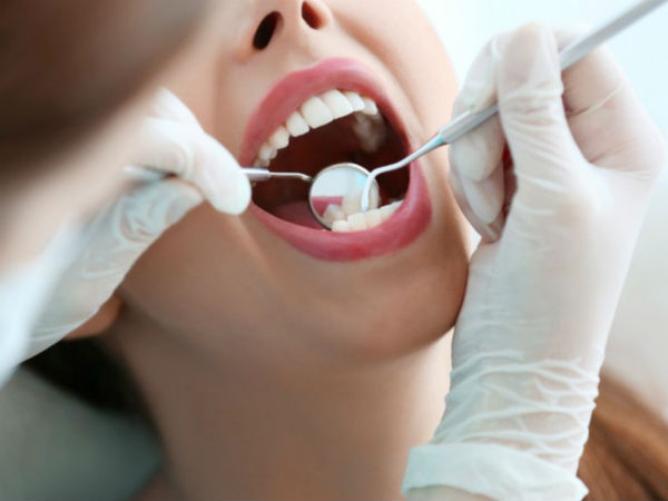 Bệnh tật thực sự từ miệng mà ra: Loại vi khuẩn thường 'cư trú' trong miệng này có thể là tác nhân thúc đẩy các bệnh ung thư