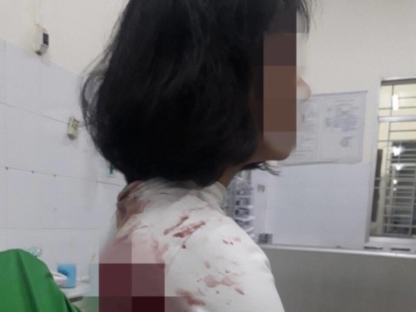 Mâu thuẫn trong trường, một nữ sinh ở Đồng Nai bị đâm trọng thương